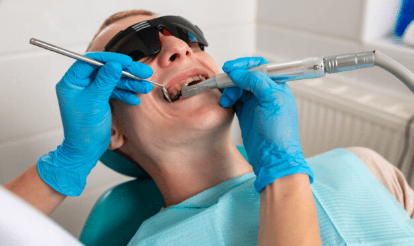 dental sealants