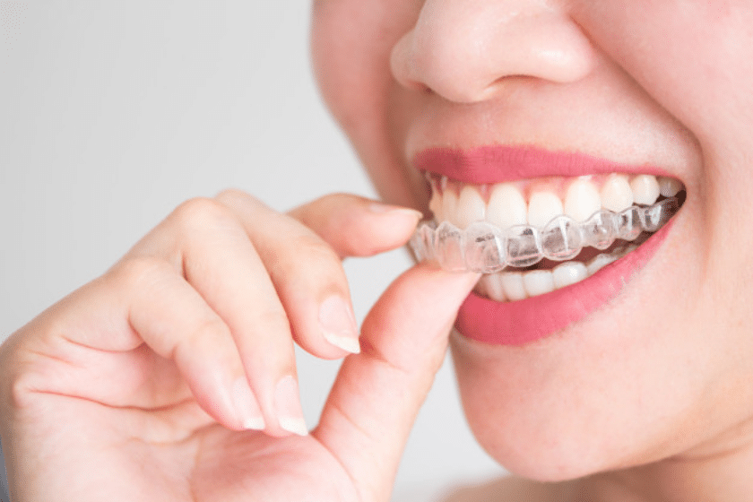 invisalign benefits