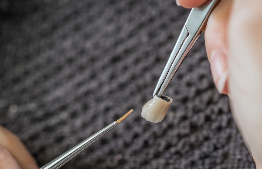dental crowns