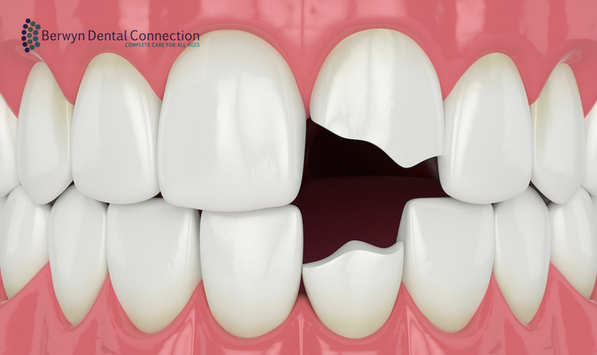 knocked out tooth