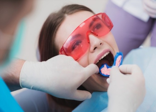 Fluoride Treatments