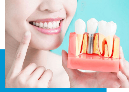 dental implants in berwyn