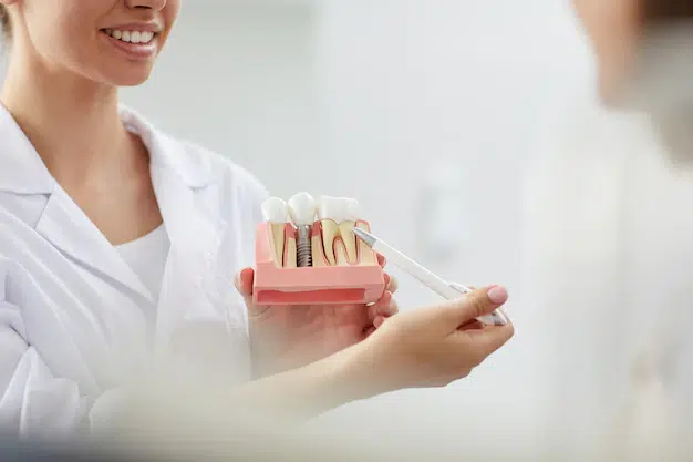 dental implants in berwyn