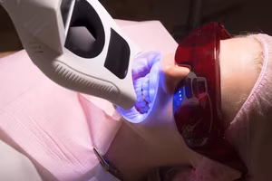 tooth replacement in berwyn