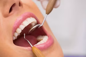wisdom tooth removal in Berwyn