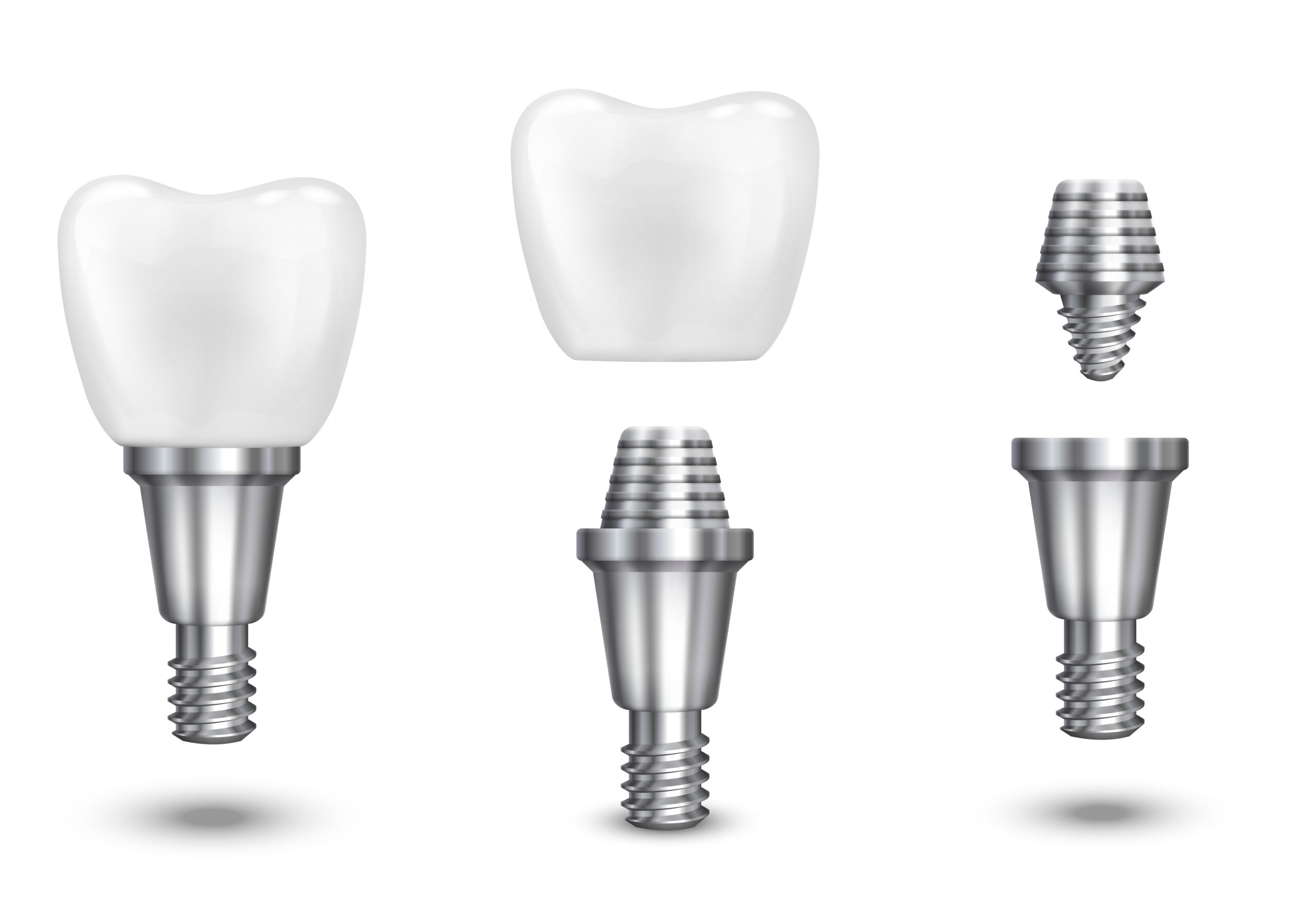 dental implant in berwyn il, berwyn dental connection