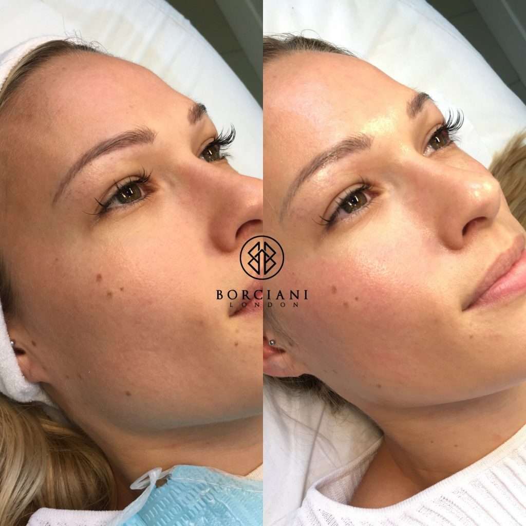 The best facials London has to offer 2 sr38 1024x1024 1