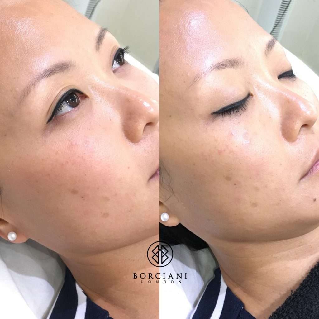 The best facials London has to offer 4 sr40