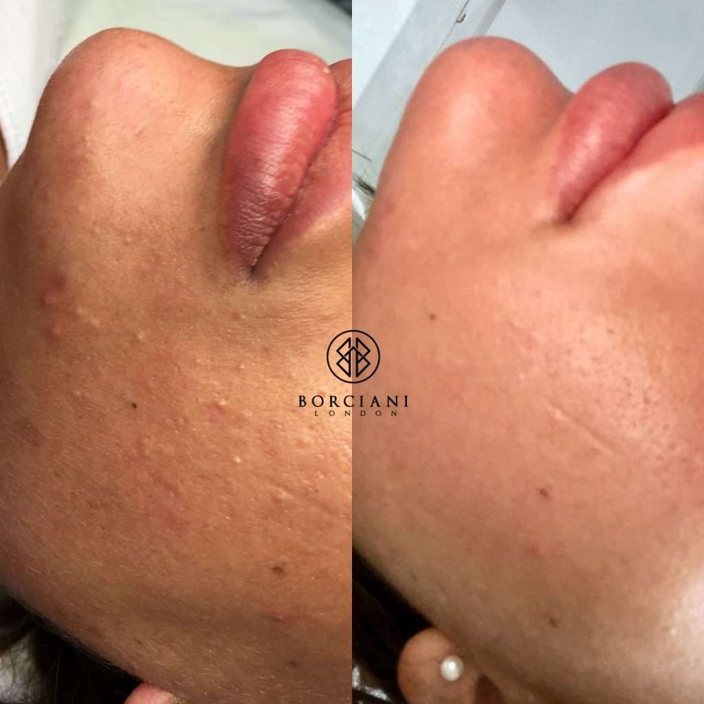 The best facials London has to offer 3 sr41