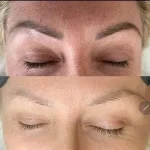 C92436C2-2D56-4EA4-96E1-BD281E31AA25-11408-00000497942D9BEF Permanent Makeup removal