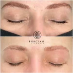 FD1F1568-318F-4558-A22F-585B73BB9626_1_105_c Permanent Makeup removal
