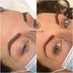 IMG_3641 Emergency Permanent Makeup removal