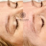 IMG_4086 Permanent Makeup removal