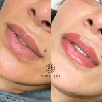 16115EC4-D1C9-4ADC-B5D8-7A591407A869 Lip Blush Treatment Before and after