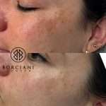191E3EBC-C3EE-40F9-B4D8-C9B9A499124C_1_105_c Pigmentation