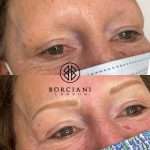 5755D848-087A-4973-AC55-B375CF482728_1_105_c Permanent Makeup Brows Alopecia