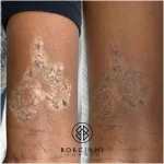 8C83269A-3A6C-459E-B600-B69FCDA7321D_1_105_c (1) scar camouflage post laser