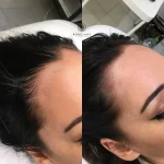 EAA69767-029F-4BDA-95BC-3005B04FD488 Hair Loss Treatment
