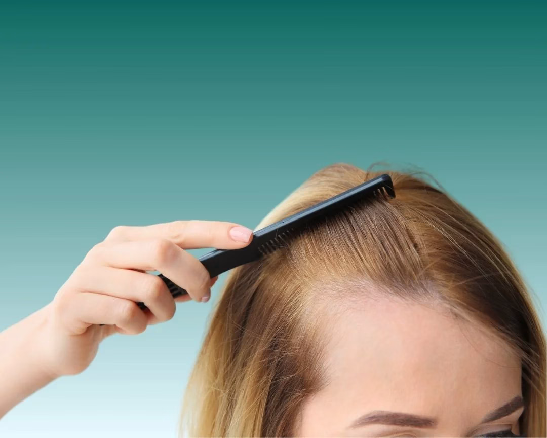 Hair-Transplant-for-Women.jpg Hair-Transplant-for-Women.jpg