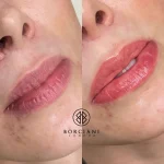 IMG_7400 Lip Blush Treatment Before and after