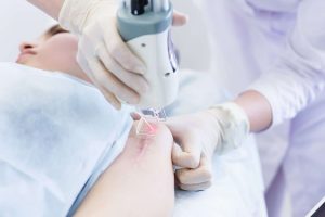 Woman,Getting,A,Laser,Skin,Treatment,Or,Laser,Resurfacing,Of shutterstock 641754232 scaled