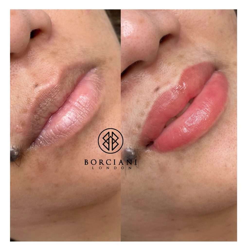 Permanent MakeUp In London 4 Lip Blush