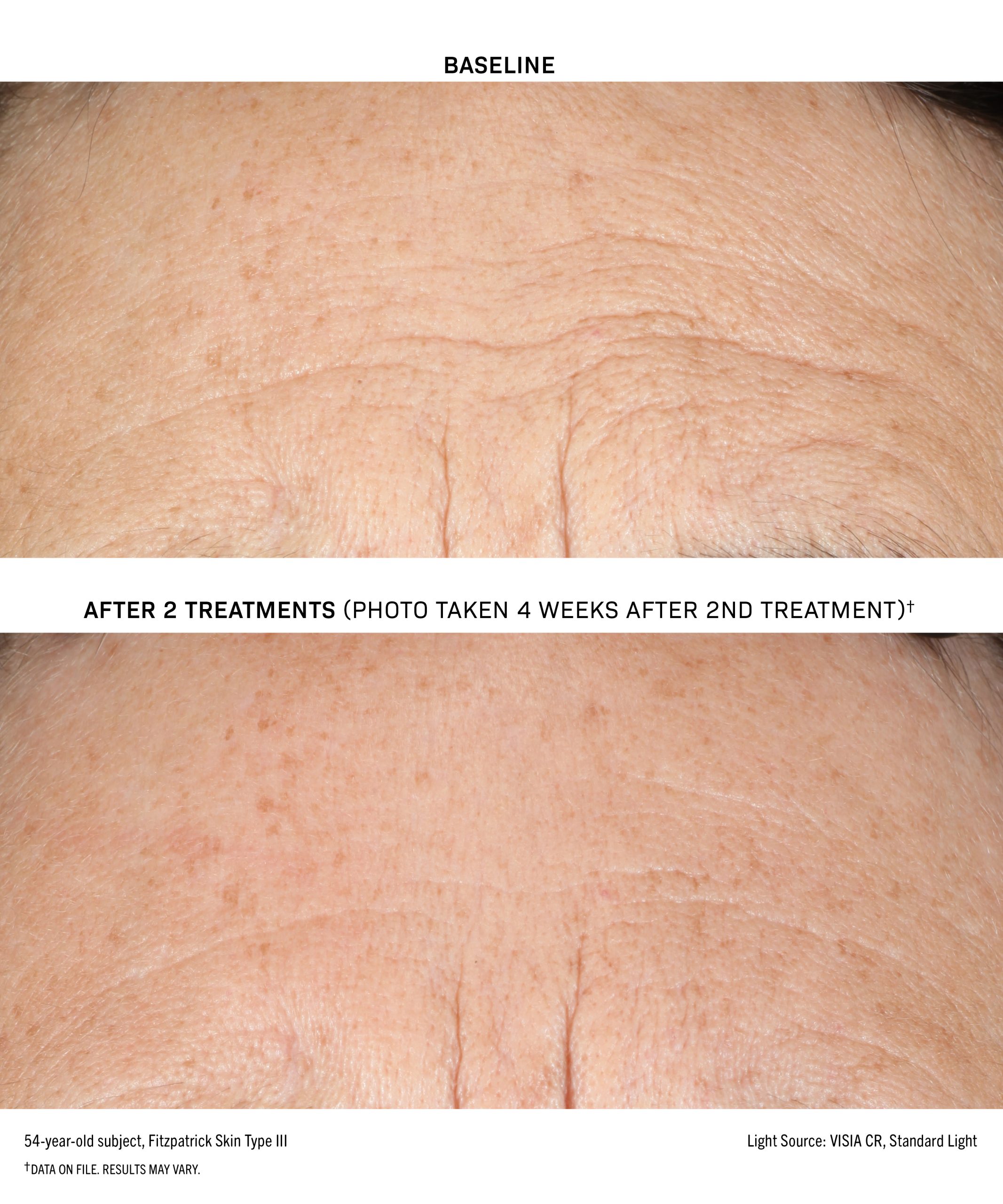 DBTS_True-Visible-Results-2-FST-III_bd_202512 DBTS True Visible Results 2 FST III bd 202512 scaled