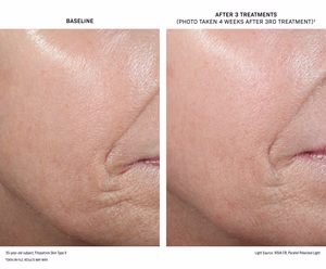 DBTS_True-Visible-Results-5-FST-II_bd_202512 DBTS True Visible Results 5 FST II bd 202512 scaled