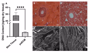 Decellularized porcine skin extracellular matrix (psECM) characterization showing reduced DNA content, histology, and SEM microstructure.