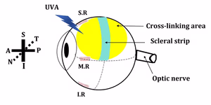Diagram showing the scleral cross-linking treatment region and location of the scleral strip used for tensile testing