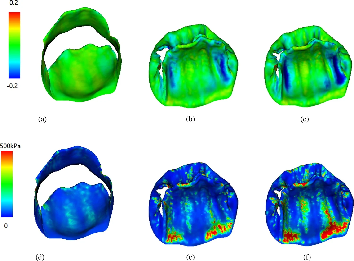 Reconstructed mitral valve model used for fluid-structure interaction simulation