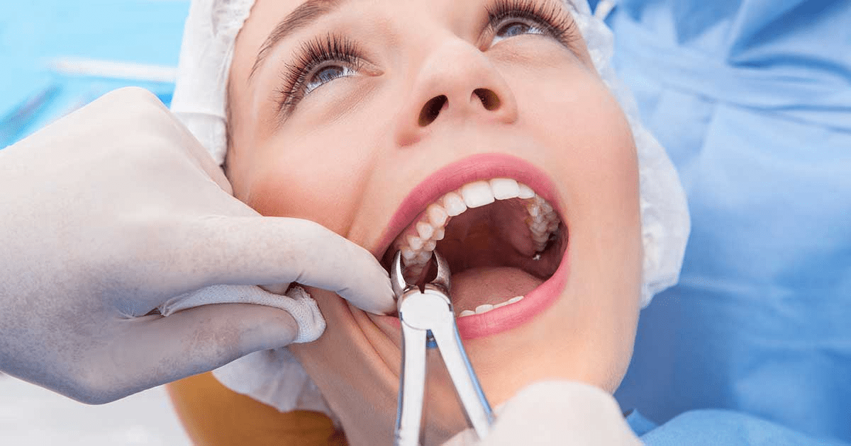 Tooth Extraction Aftercare: Dos & Don’ts for Healing