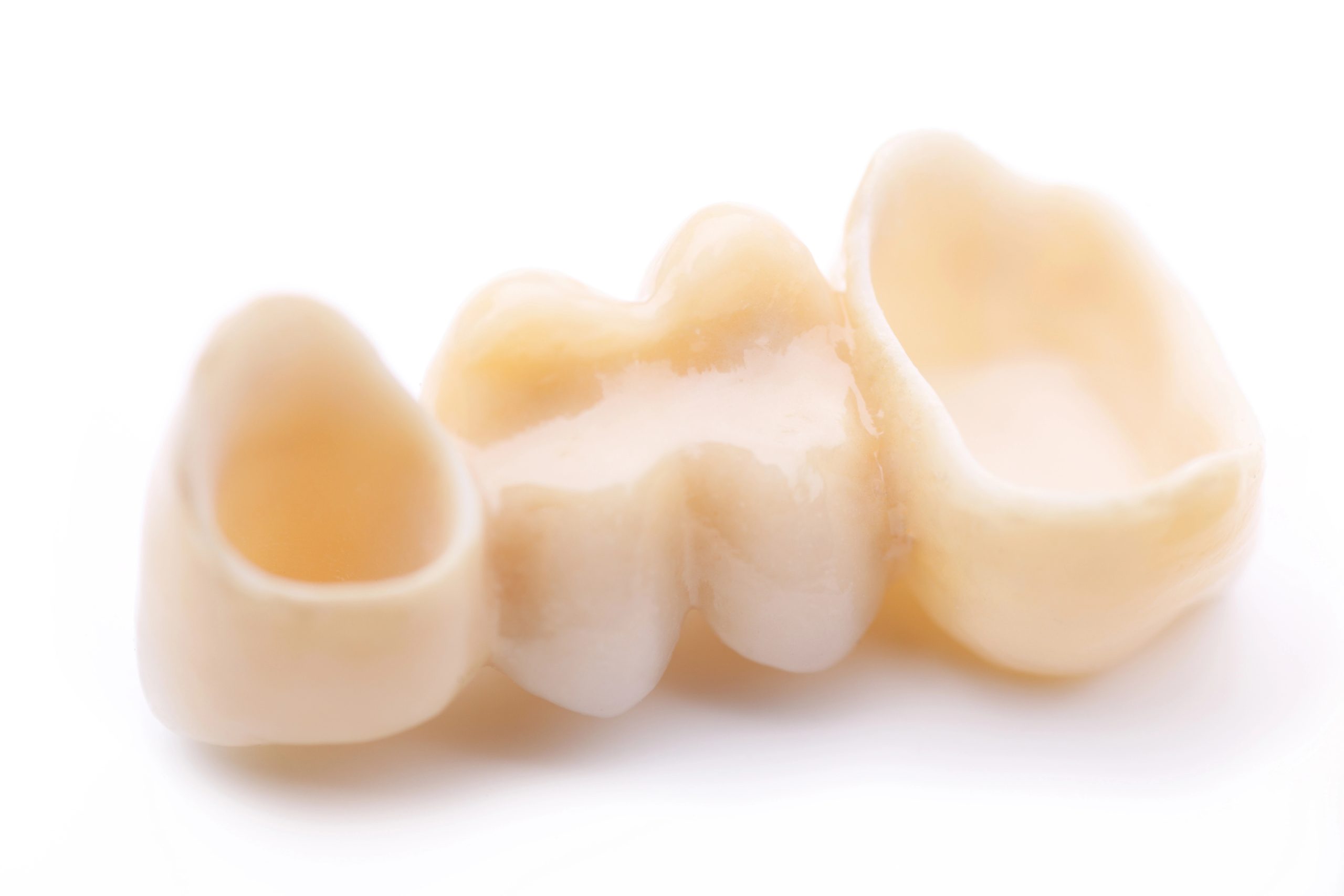 Dentures for Missing Teeth: Regain Confidence with a Complete Smile