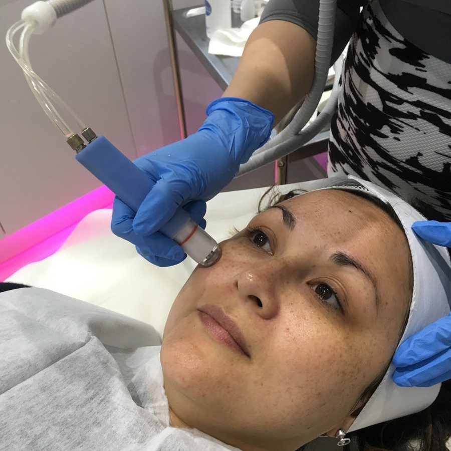 Microhydrabrasion treatment facelove Microhydrabrasion treatment facelove