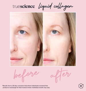 Colagénio Líquido Truescience: O segredo para uma pele, cabelo e unhas jovens 4 Colagénio Benefícios visíveis Resultados visíveis do ativo-11