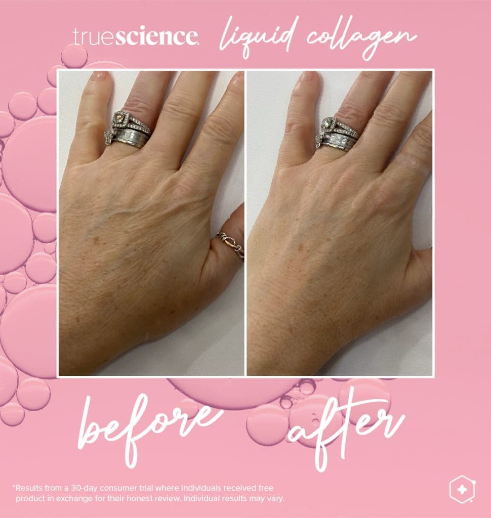 Colagénio Líquido Truescience: O segredo para uma pele, cabelo e unhas jovens 6 Colagénio Benefícios visíveis Resultados visíveis_Assets-12