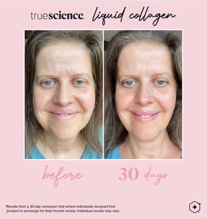 Colagénio Líquido Truescience: O segredo para uma pele, cabelo e unhas jovens 10 Colagénio Benefícios visíveis Resultados visíveis do ativo-14