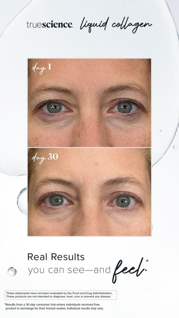 Colagénio Líquido Truescience: O segredo para uma pele, cabelo e unhas jovens 9 Colagénio Benefícios visíveis Resultados visíveis do ativo-18