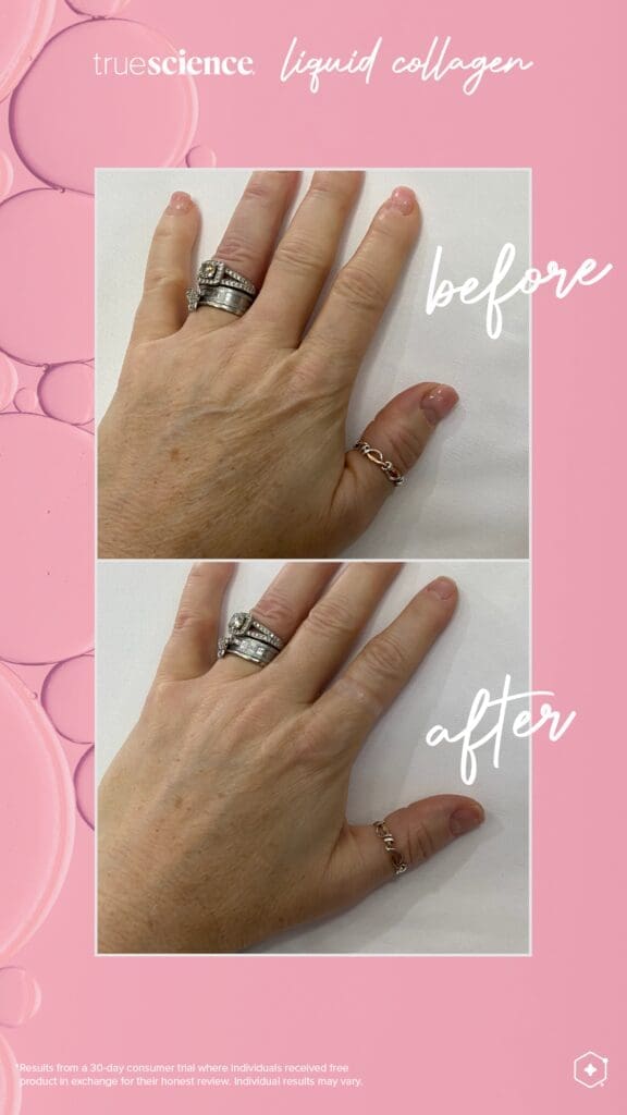 Colagénio Líquido Truescience: O segredo para uma pele, cabelo e unhas jovens 7 Colagénio Benefícios visíveis Resultados visíveis_de activos-19