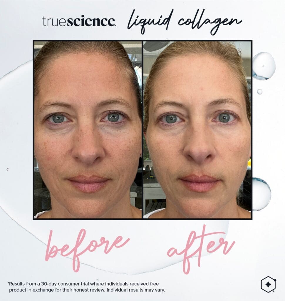 Colagénio Líquido Truescience: O segredo para uma pele, cabelo e unhas jovens 8 Colagénio Benefícios visíveis Resultados visíveis_Assets-20