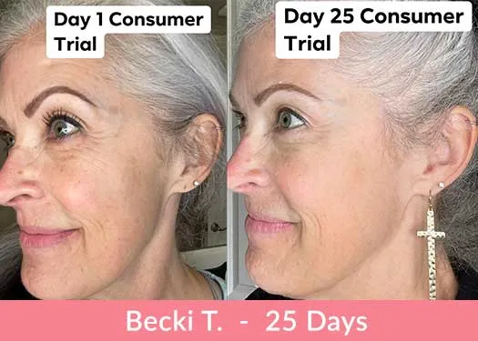 Doorbreek de mythes: Echte feiten in deze Liquid Collagen Review 4 becki t getuigenis 25 dagen
