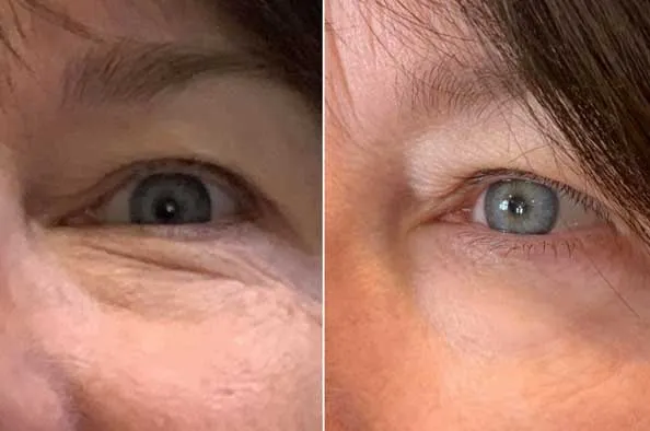 Doorbreek de mythes: Echte feiten in deze Liquid Collagen Review 18 vloeibare collageen ogen