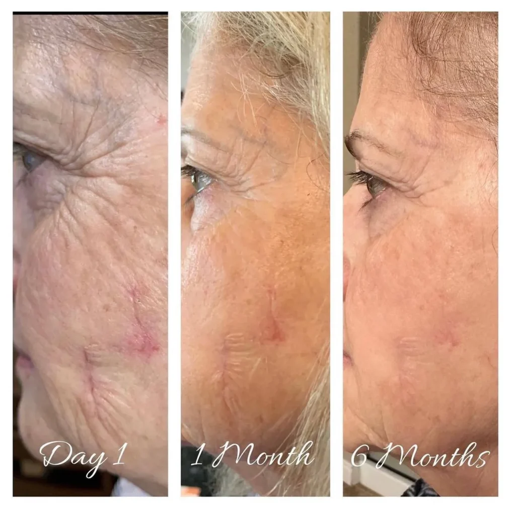 Doorbreek de mythes: Echte feiten in deze Liquid Collagen Review 16 vloeibare collageen resultaten 1