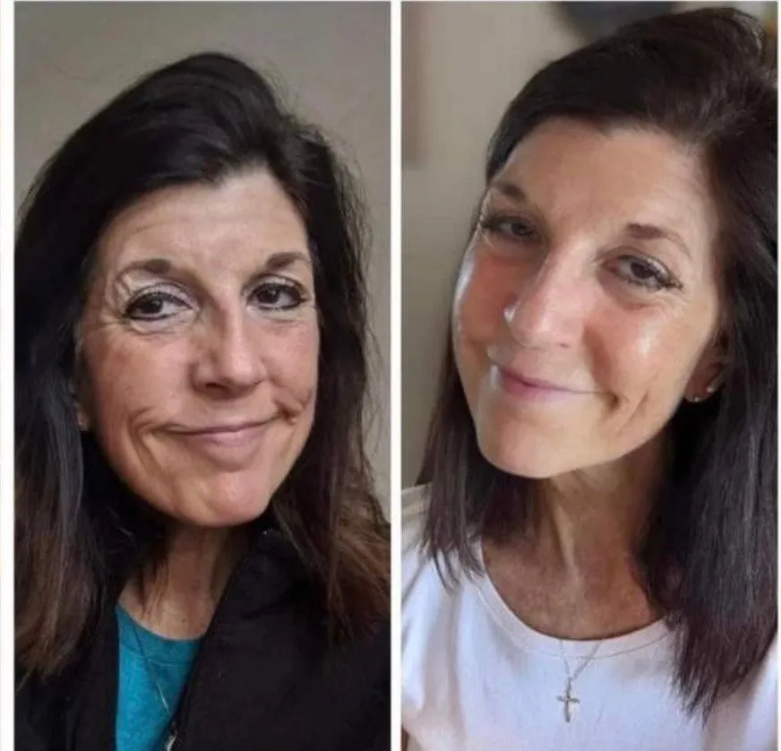 Doorbreek de mythes: Echte feiten in deze Liquid Collagen Review 15 vloeibare collageen resultaten 10