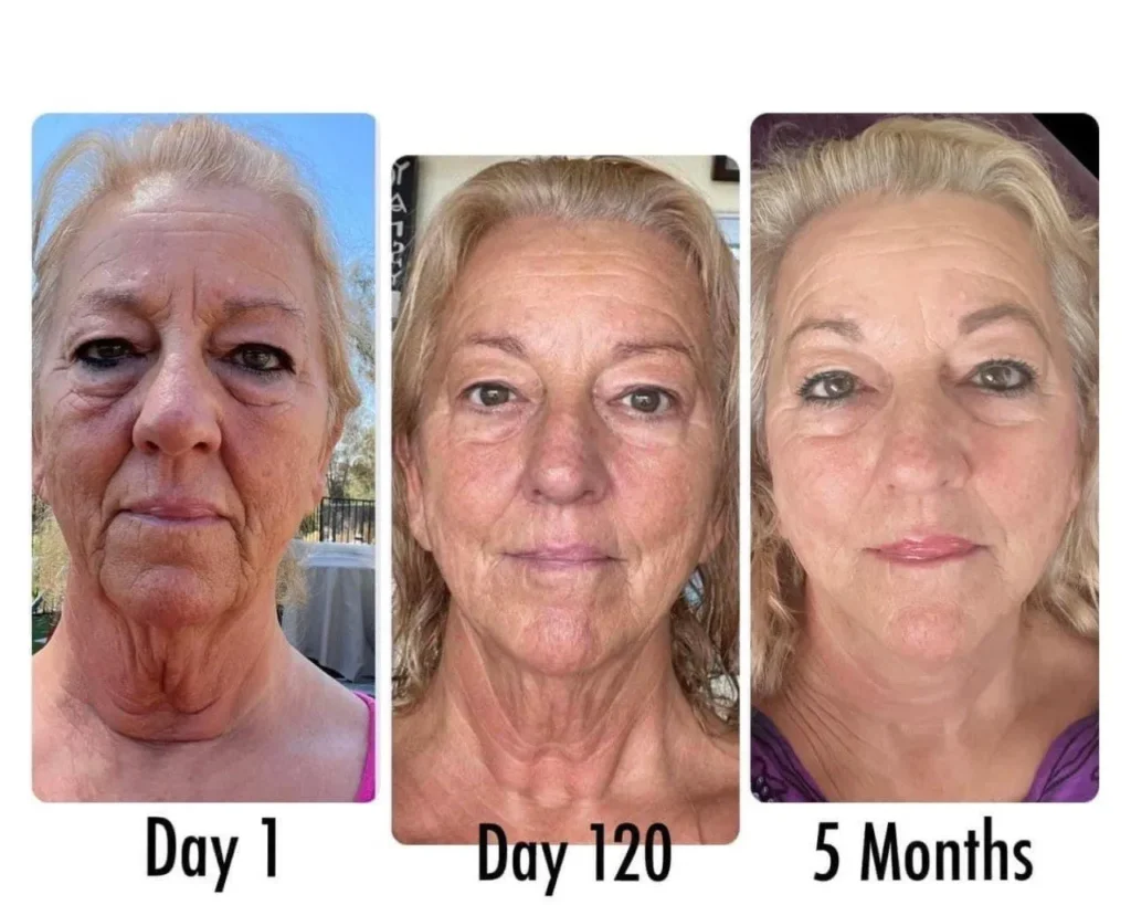 Doorbreek de mythes: Echte feiten in deze Liquid Collagen Review 9 vloeibare collageen resultaten 13