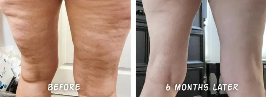 Doorbreek de mythes: Echte feiten in deze Liquid Collagen Review 25 vloeibare collageen resultaten 14