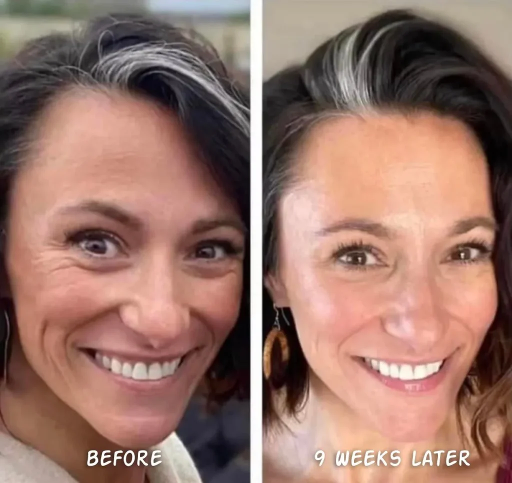 Doorbreek de mythes: Echte feiten in deze Liquid Collagen Review 12 vloeibare collageen resultaten 15