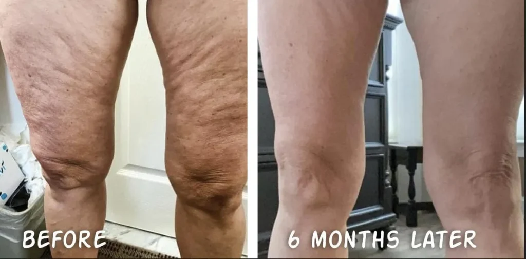 Doorbreek de mythes: Echte feiten in deze Liquid Collagen Review 24 vloeibare collageen resultaten 16
