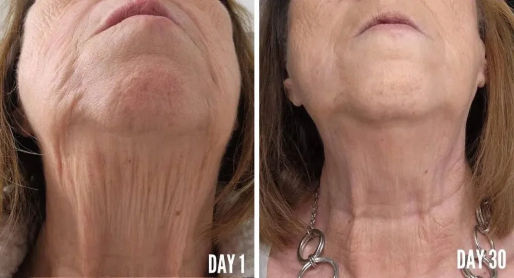 Doorbreek de mythes: Echte feiten in deze Liquid Collagen Review 10 vloeibare collageen resultaten 3