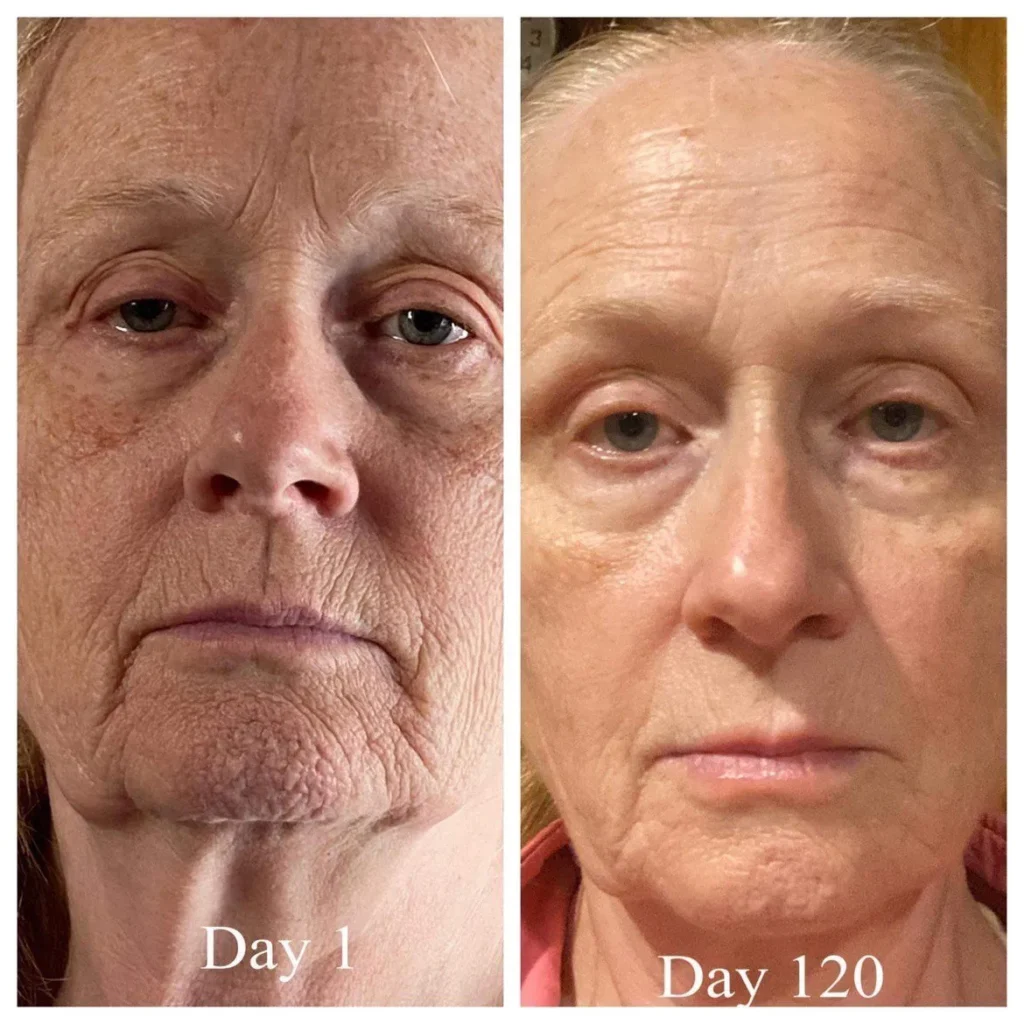 Doorbreek de mythes: Echte feiten in deze Liquid Collagen Review 11 vloeibare collageen resultaten 4